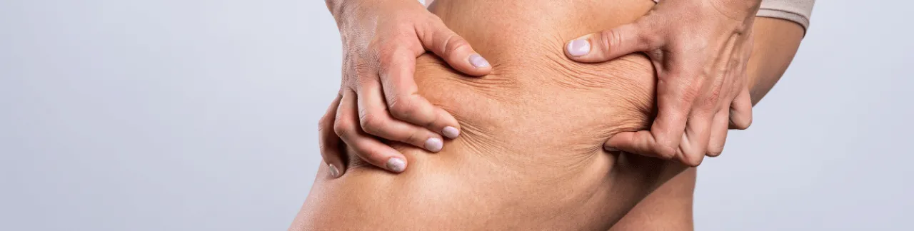 kobieta z figurą gruszka, przyczyny bryczes&oacute;w