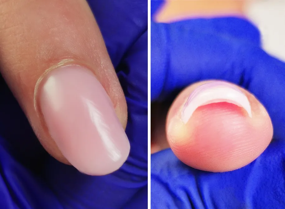 Zdjęcie Przedłużanie obgryzionych paznokci: Jak odzyskać piękny wygląd?