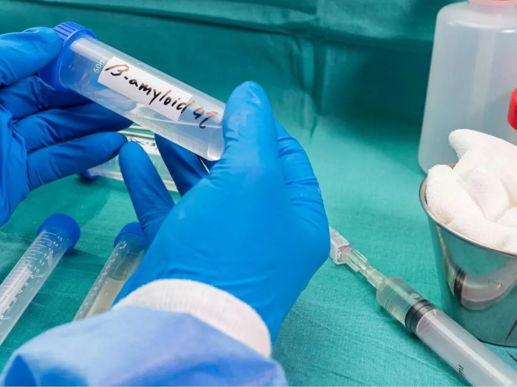 Zdjęcie Jakie badania na Alzheimera? Kompleksowy przegląd diagnostyki