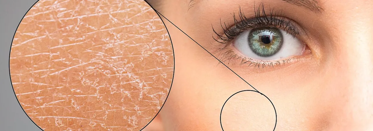 Hautarzt trockene schuppige Haut