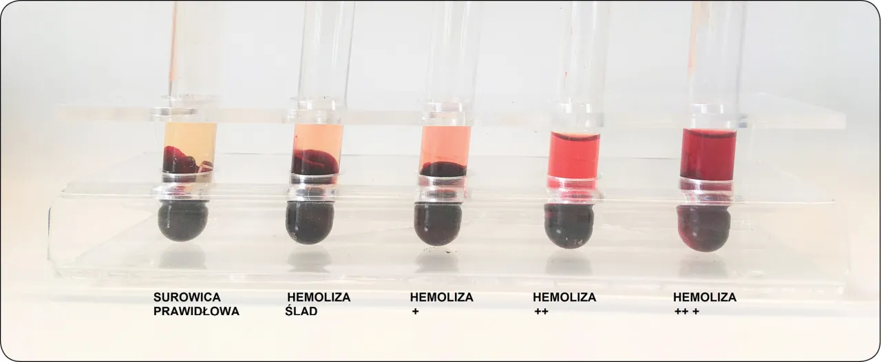 pr&oacute;bka krwi nieprawidłowa hemoliza