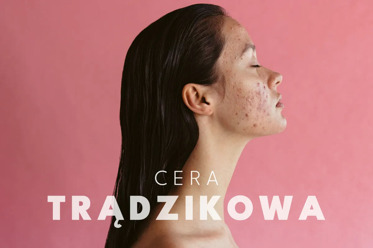 codzienna pielęgnacja cery trądzikowej