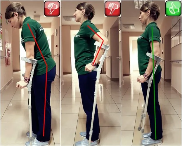 jak prawidłowo dopasować kule ortopedyczne