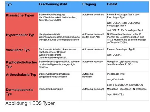 Ehlers-Danlos-Syndrom Symptome &Uuml;bersicht