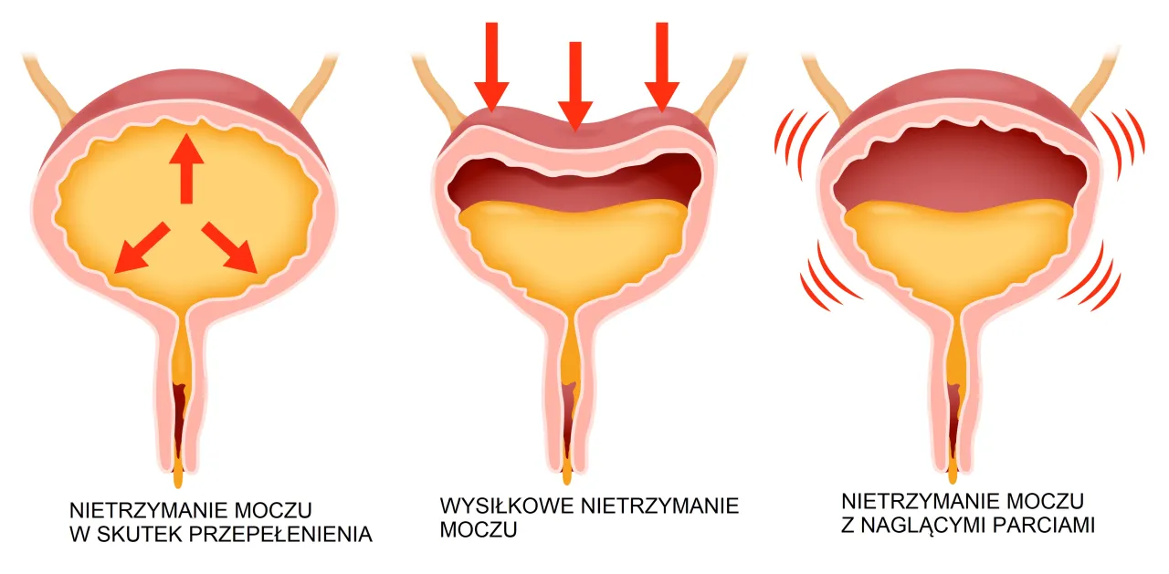 schemat układu moczowo-płciowego kobiety, ginekolog urolog różnice
