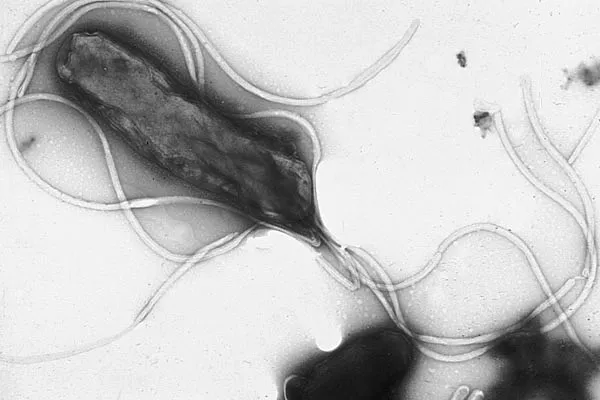 Helicobacter pylori bakteria mikroskop