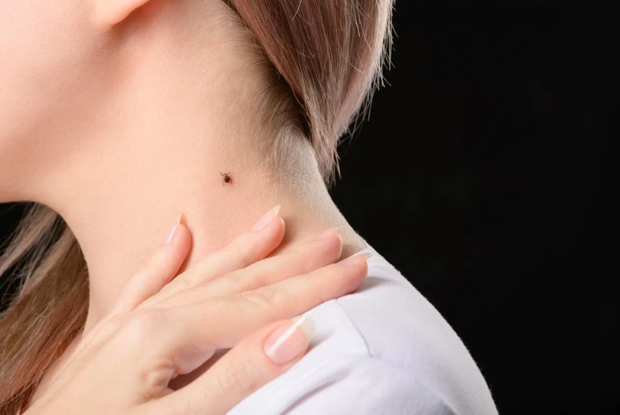 kleszcz a pieprzyk, kleszcz a pająk