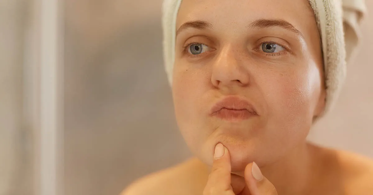 Kiedy iść do dermatologa z pryszczem podsk&oacute;rnym