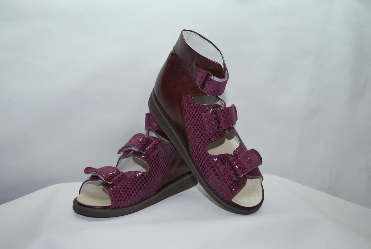 obuwie zdrowotne po operacji stopy