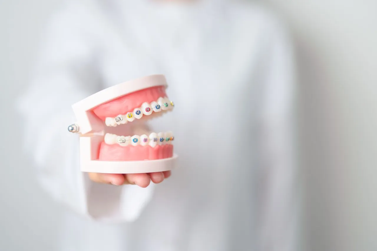 czynniki wpływające na cenę aparatu ortodontycznego