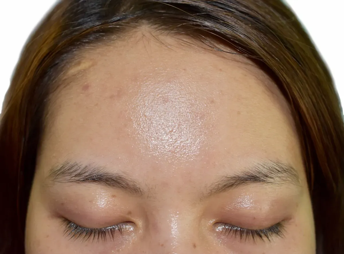 dieta a cera tłusta czego unikać