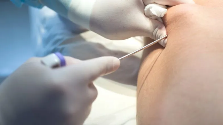 badanie szpiku kostnego cena prywatnie NFZ