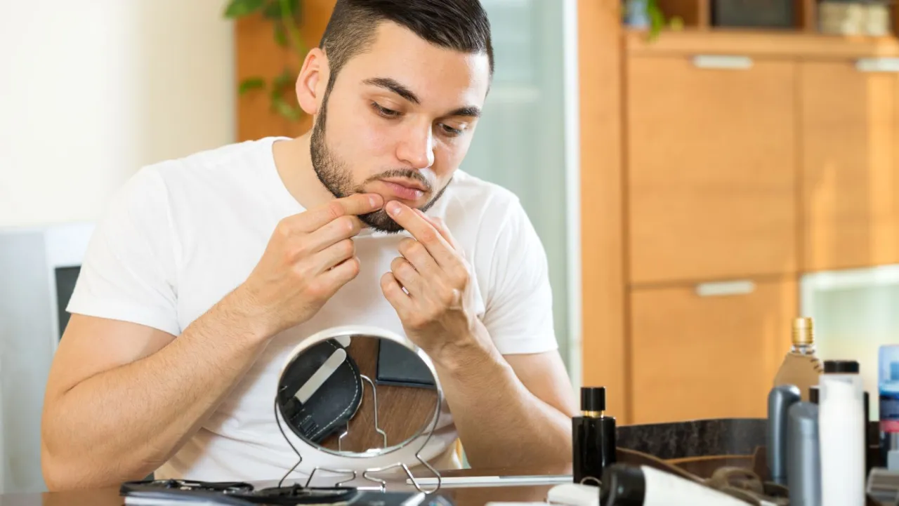 Zdjęcie Jak pozbyć się pryszczy w jeden dzień - skuteczne i szybkie metody