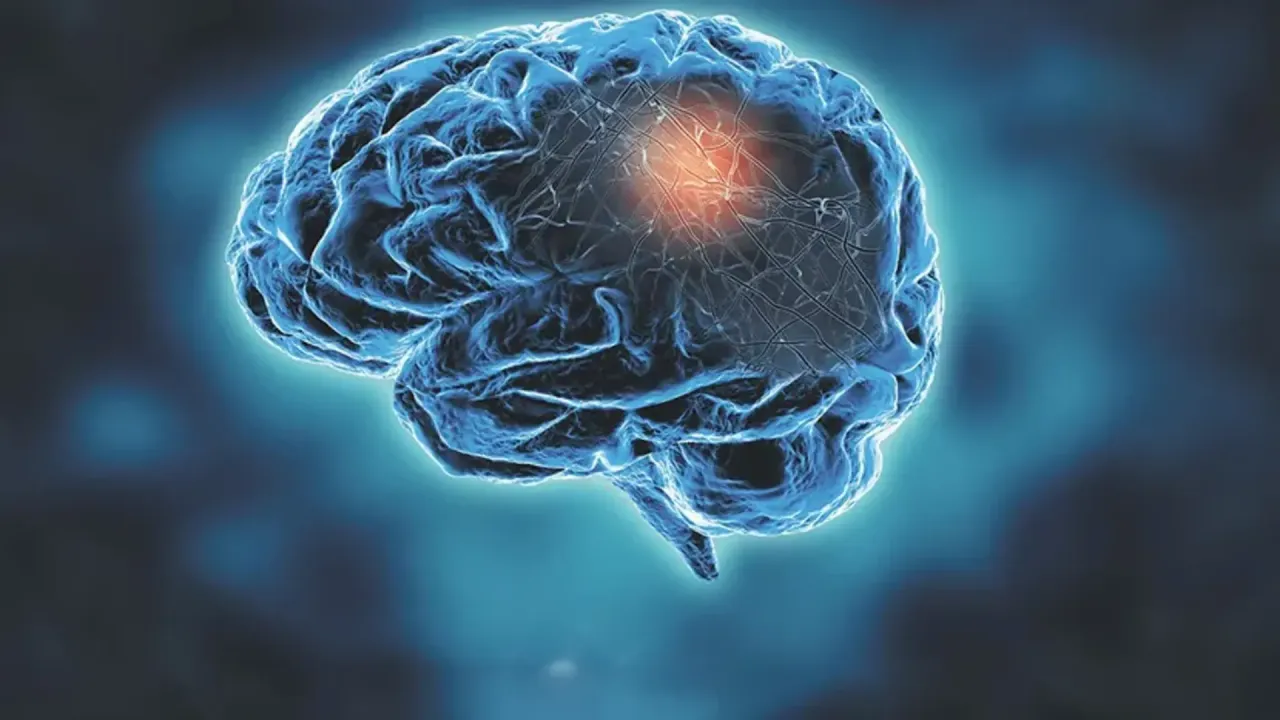 schemat leczenia stwardnienia rozsianego w polsce