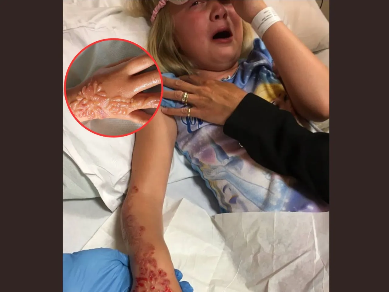 dziecko tatuaż z henny ryzyko