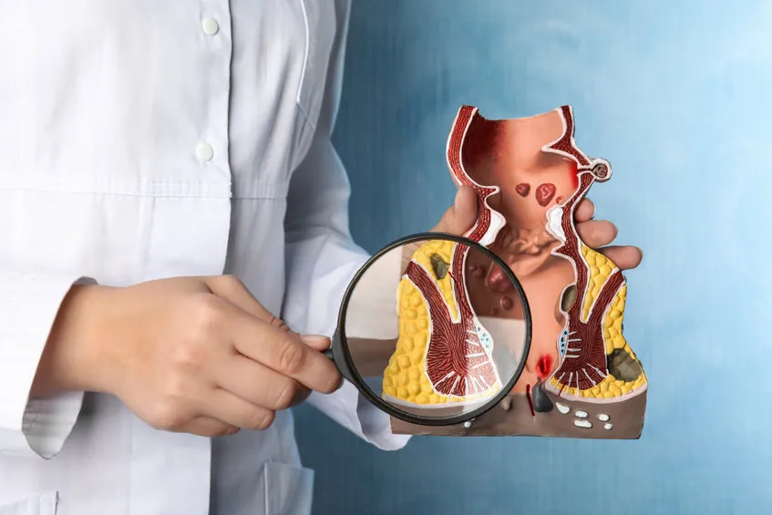 Lekarz proktolog gabinet wizyta badanie