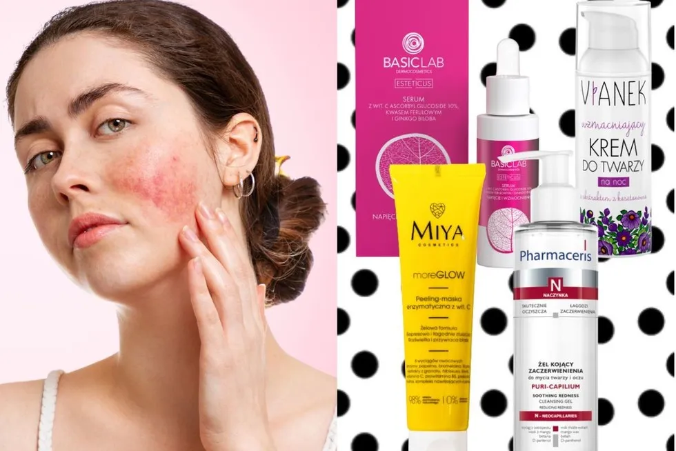 pielęgnacja cery naczynkowej kosmetyki