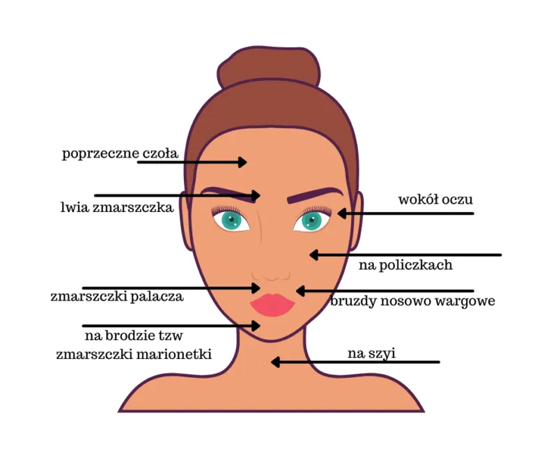 Czynniki wpływające na trwałość botoksu infografika