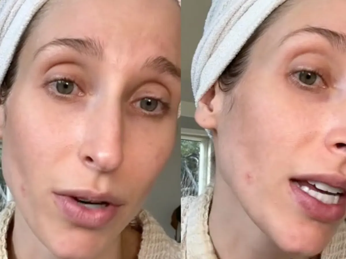 kobieta wyciskająca pryszcza na twarzy