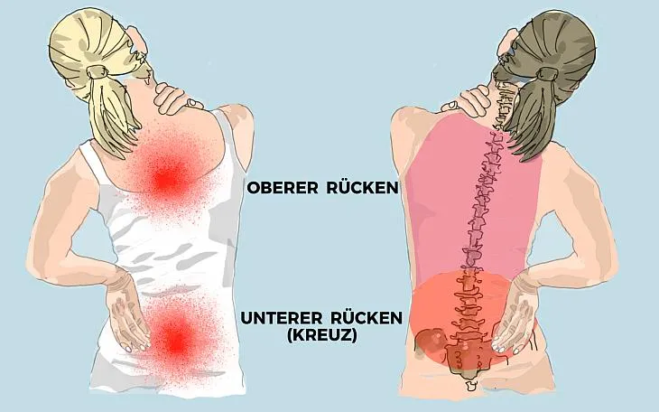 Zdjęcie Die entscheidenden Schritte zur Diagnostik von Morbus Bechterew