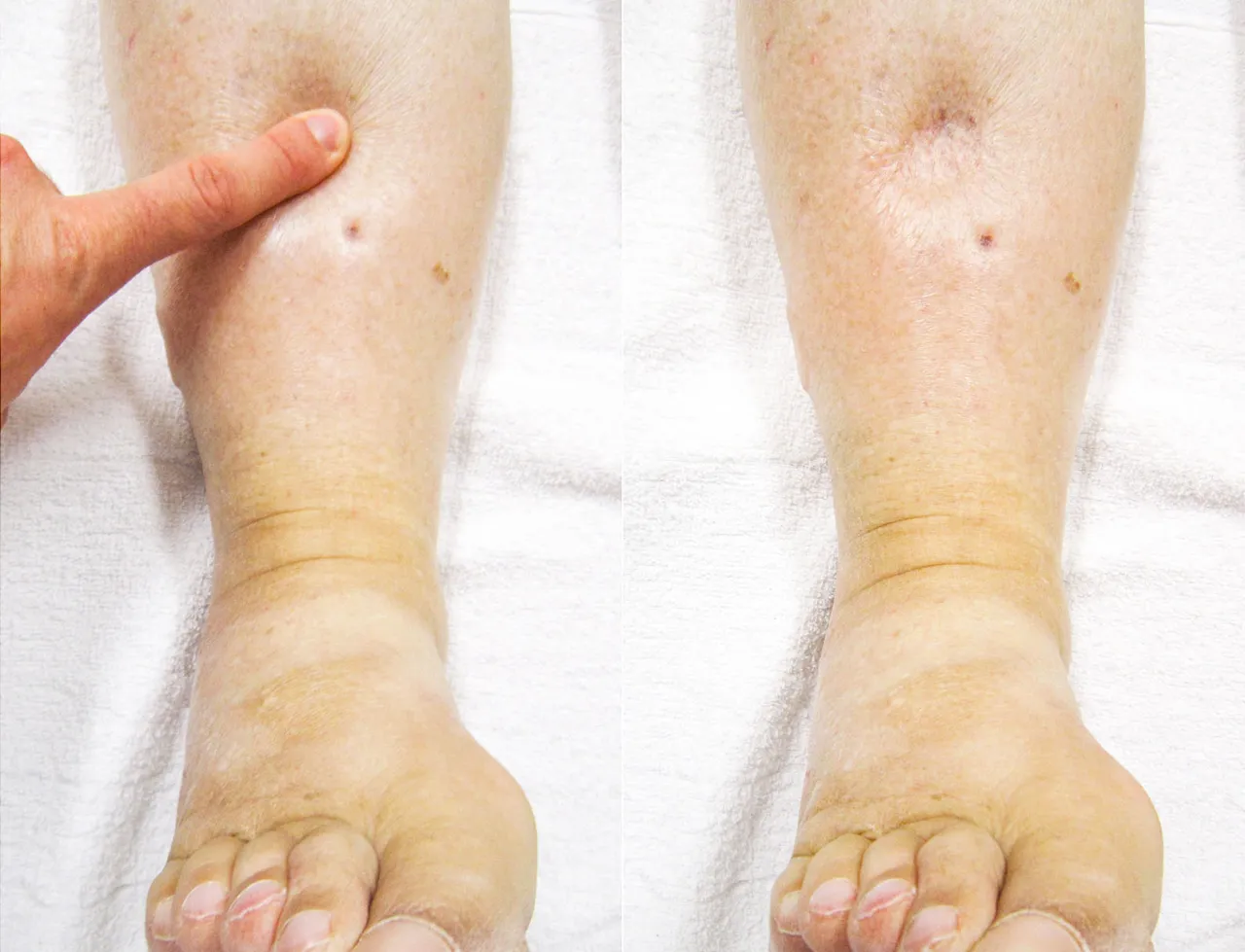 Układ limfatyczny człowieka schemat