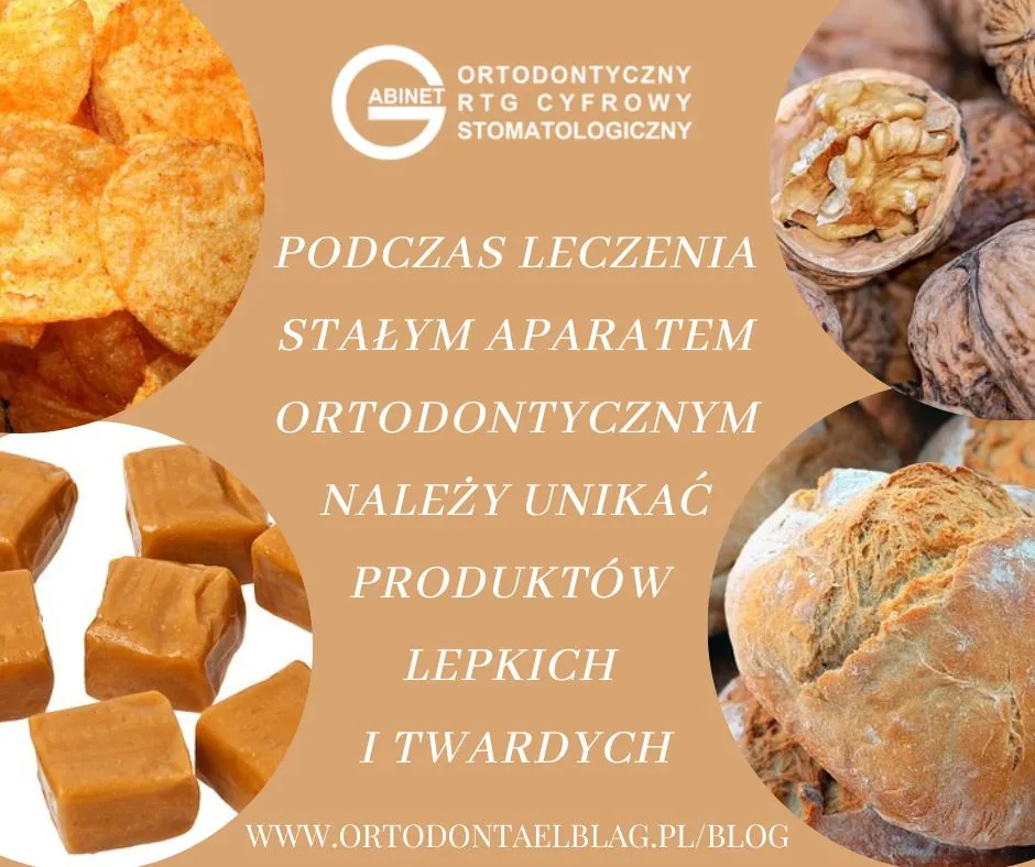 Produkty zakazane aparat ortodontyczny