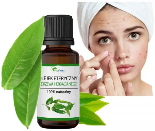 domowe sposoby na pryszcze, plasterki na wypryski, olejek z drzewa herbacianego