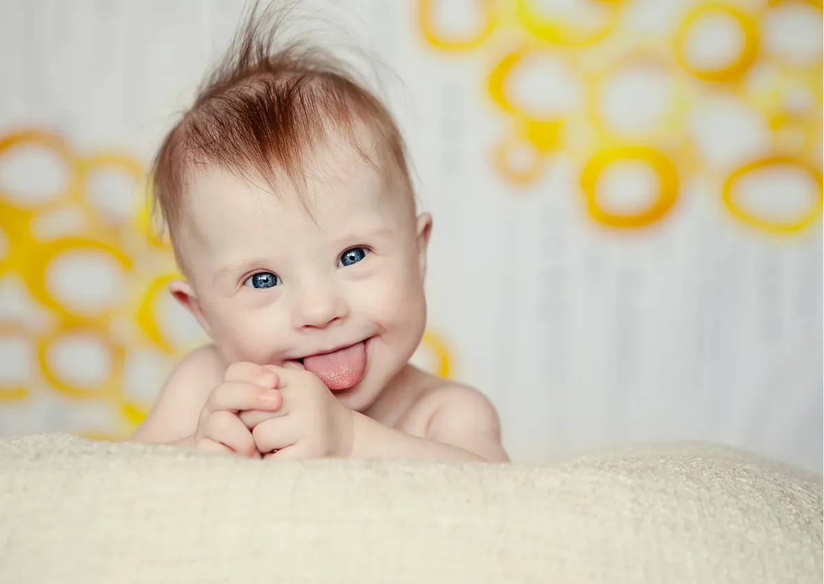 Dziecko z zespołem Downa uśmiechnięte