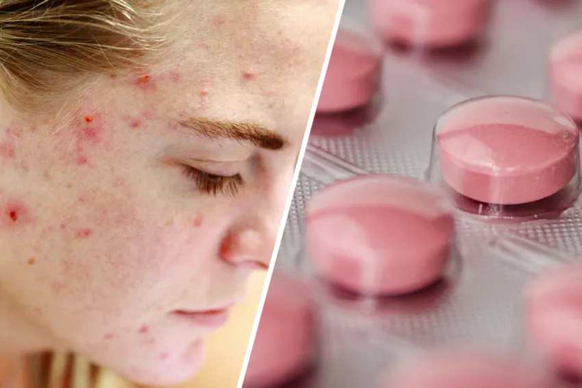 Akne Hautausschlag Vitamin B12