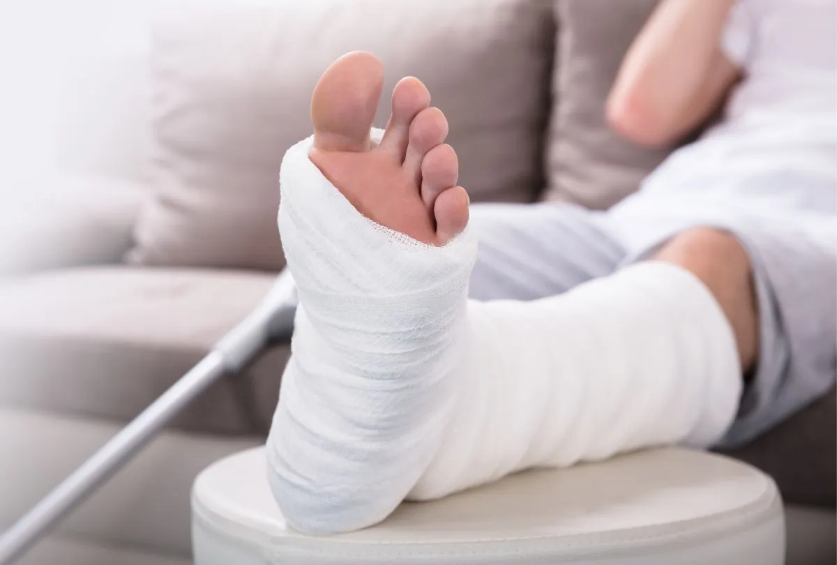 stopa w gipsie po złamaniu pięty