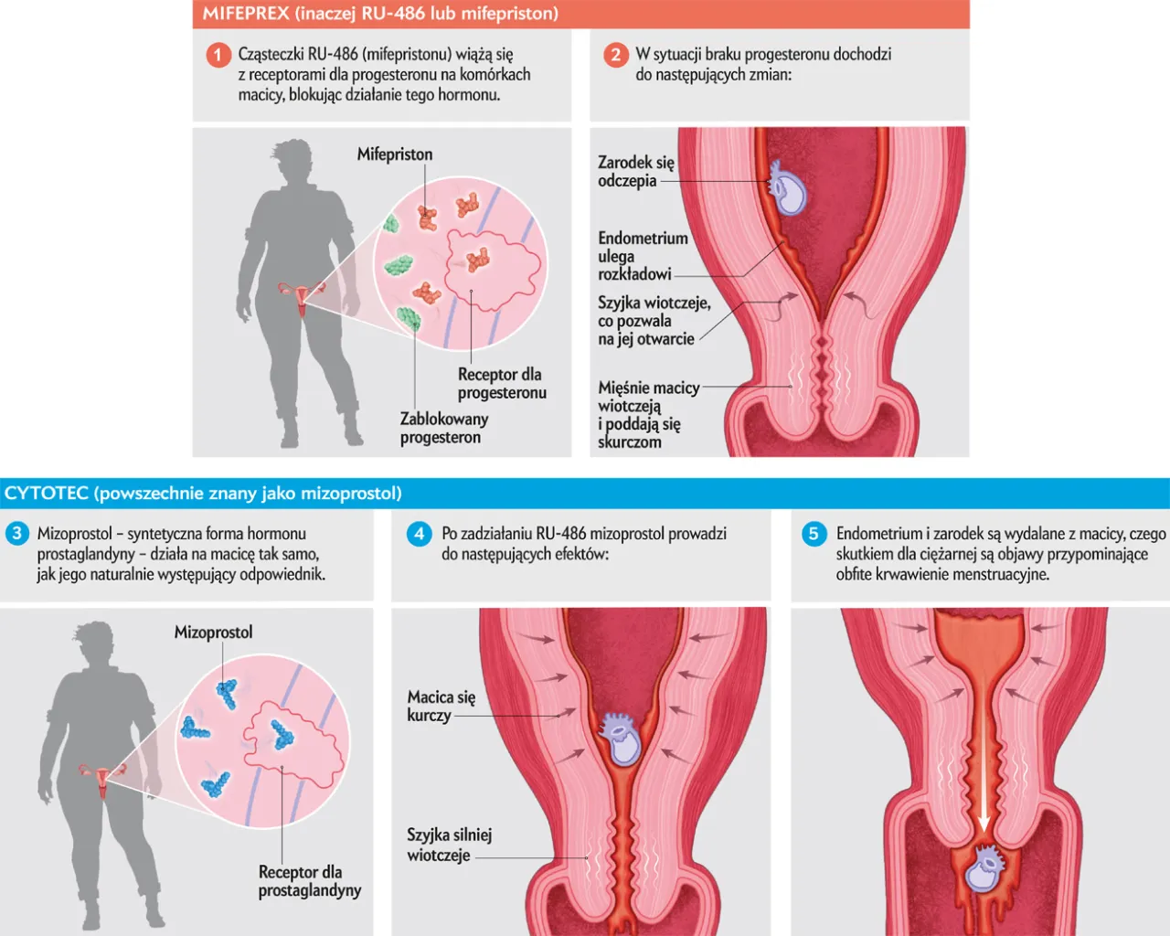 Aborcja farmakologiczna schemat działania lek&oacute;w