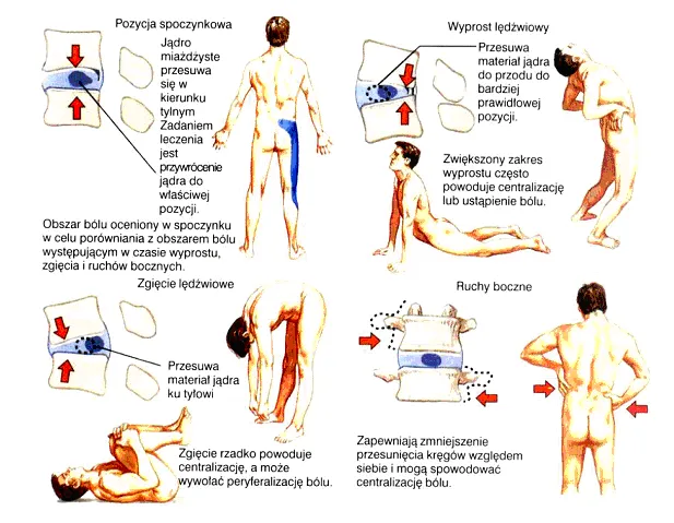 metody fizjoterapii kręgosłupa ilustracja