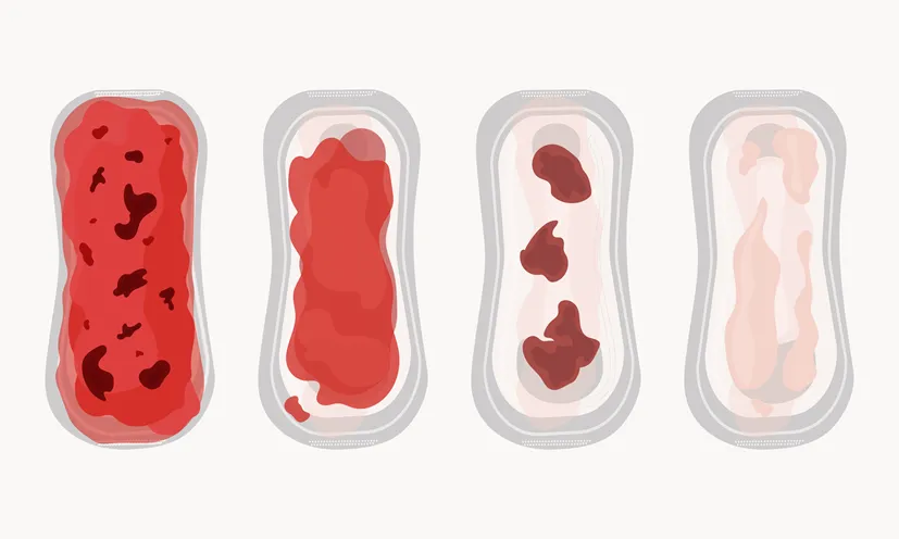 odchody połogowe etapy kolory