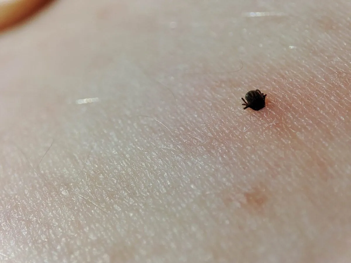 kleszcz wbity w skórę