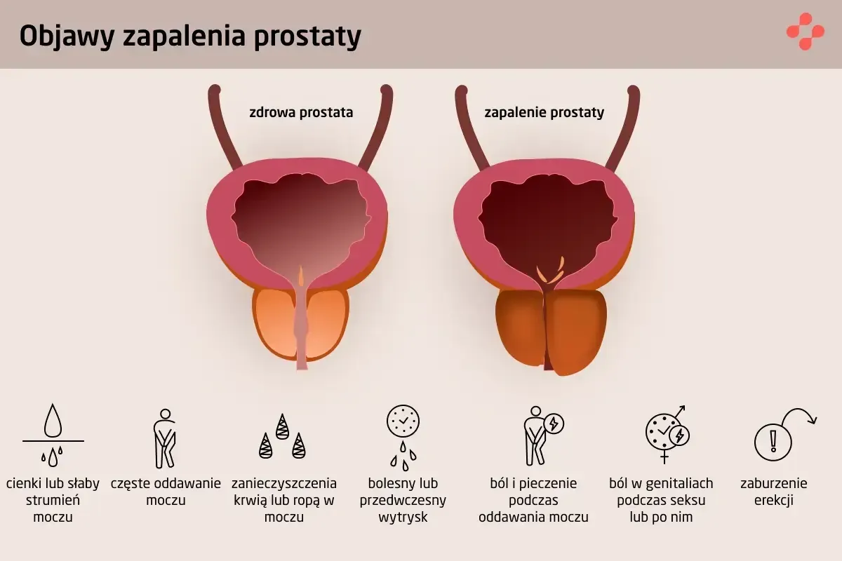 Typowe męskie problemy urologiczne