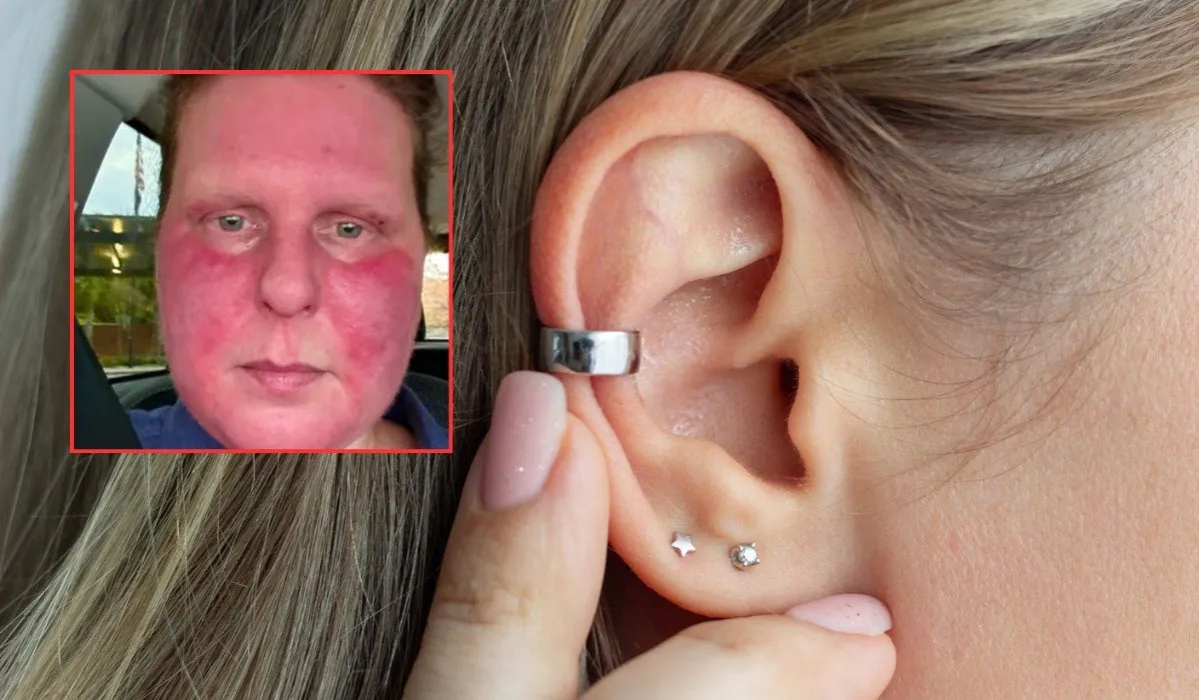 objawy infekcji piercing ucha