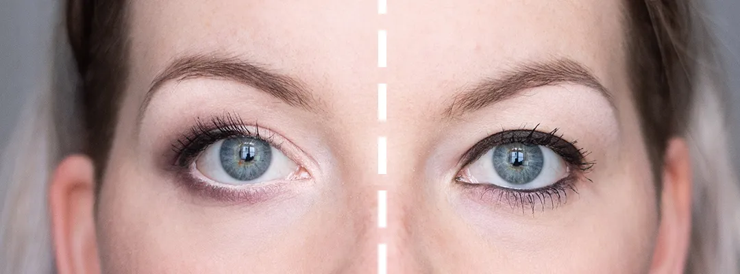 Augen Make-up Schlupflider vorher nachher