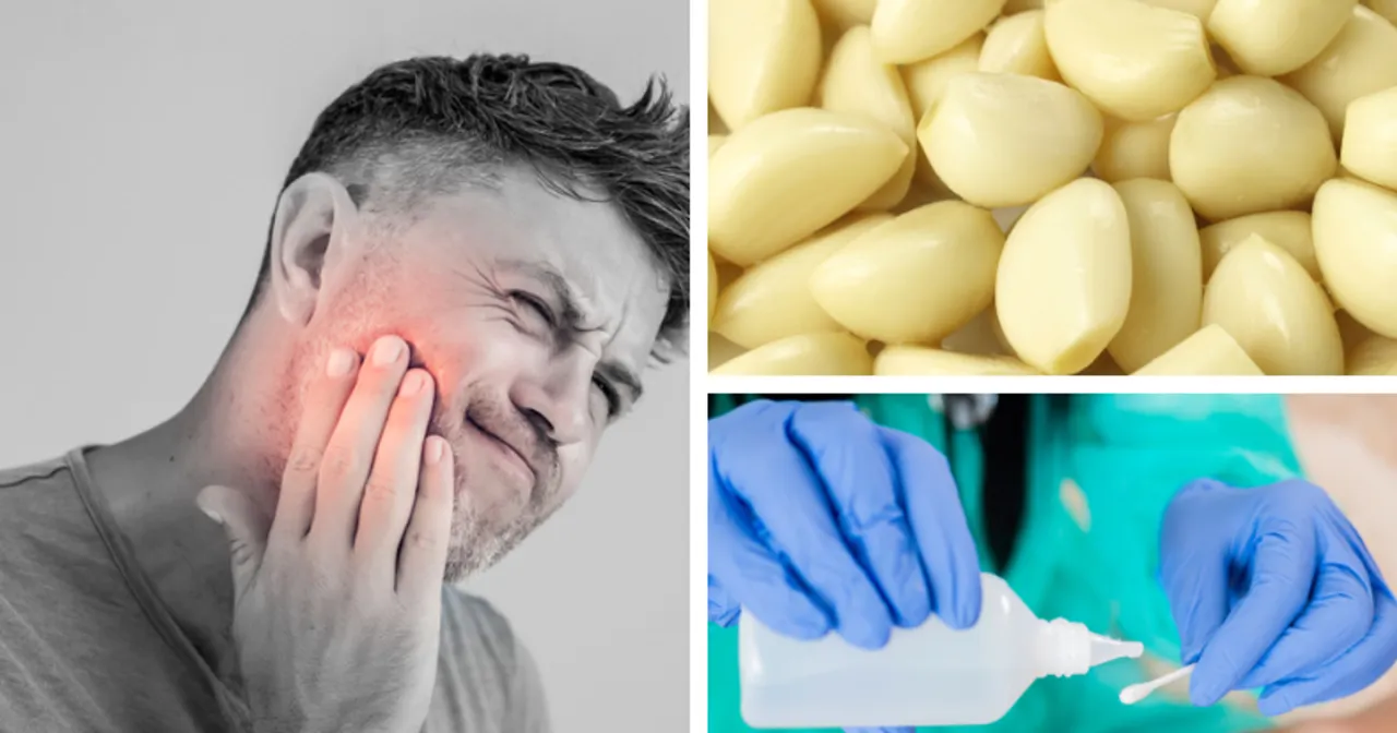 domowe sposoby na ból zęba, goździki, okład z lodu