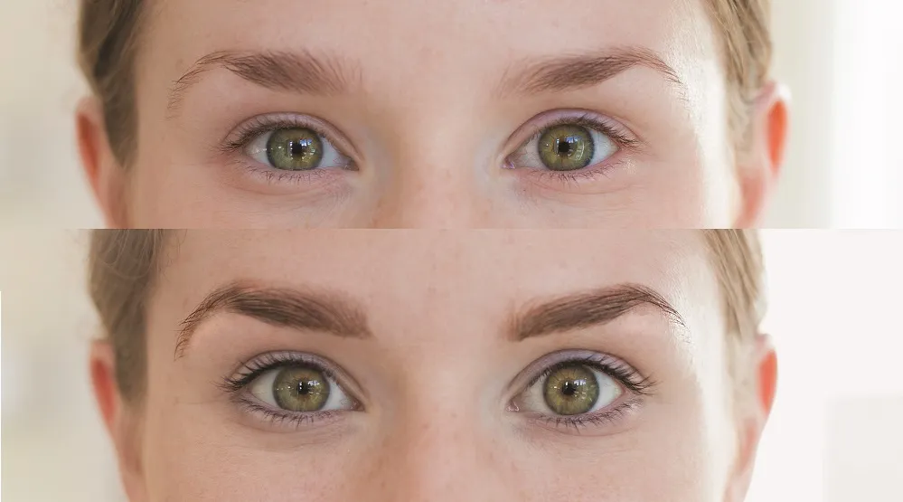 refectocil sensitive before after