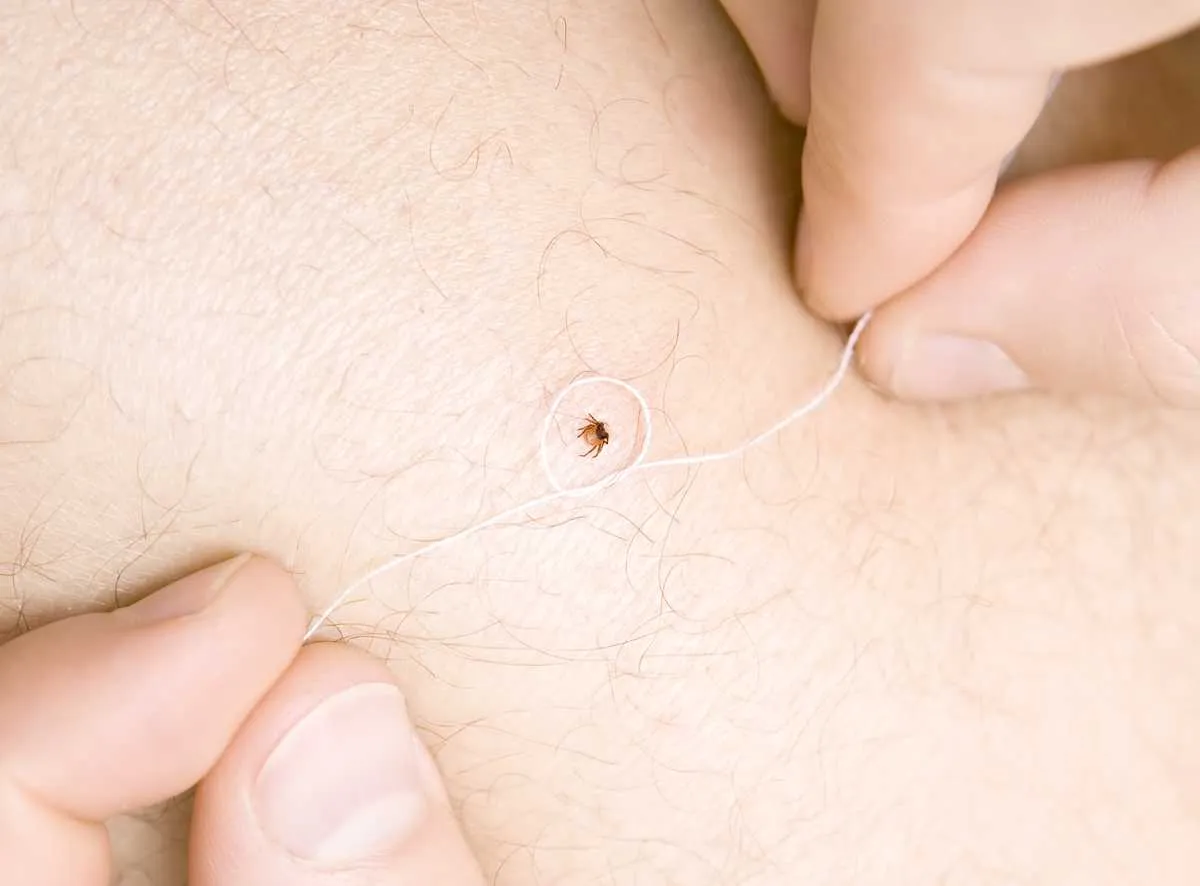 wygląd wbitego kleszcza w skórę