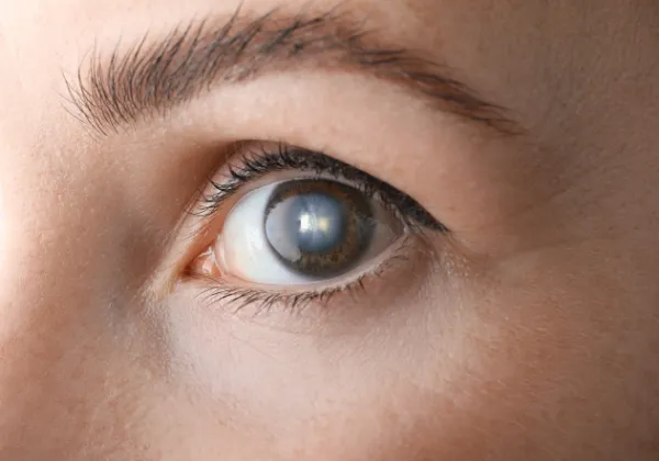 oko po operacji zaćmy rekonwalescencja