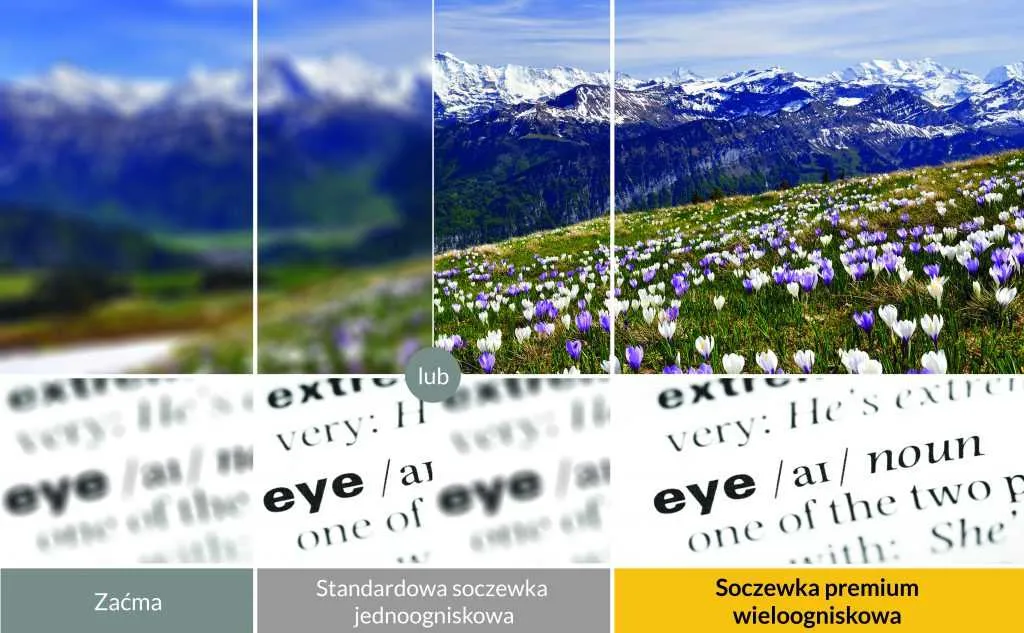 Rodzaje soczewek torycznych porównanie