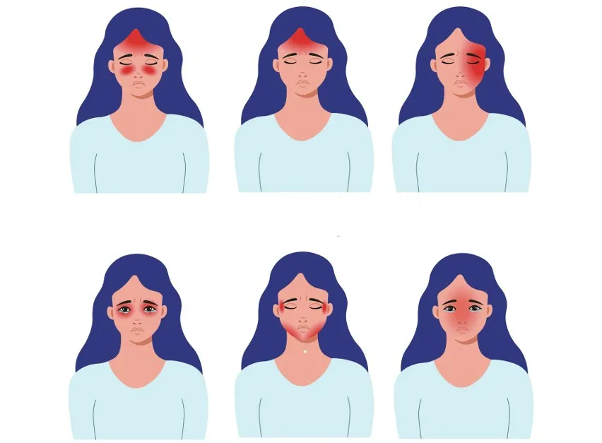 Kiedy b&oacute;l głowy jest niebezpieczny objawy