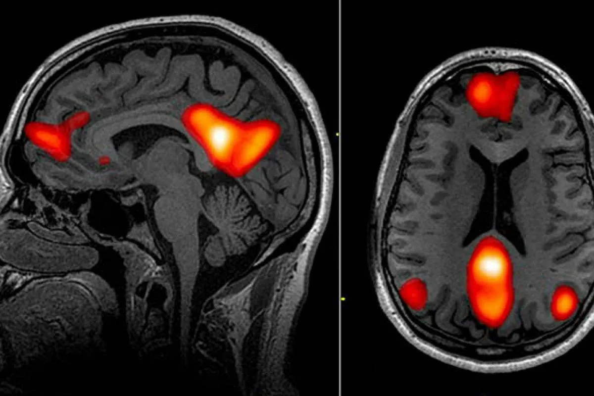 m&oacute;zg czytanie rezonans magnetyczny