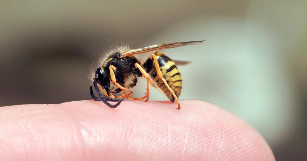 Osa na palcu. Gdy ukąsi, warto wiedzieć, co jest dobre na ukąszenie osy, by szybko złagodzić ból.