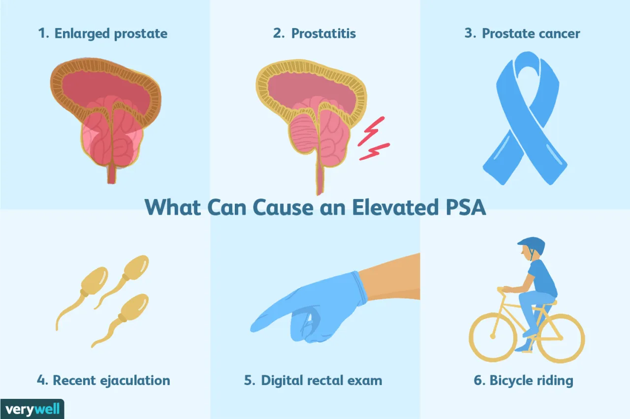 Zdjęcie PSA - Co to za badanie i dlaczego jest kluczowe dla zdrowia prostaty