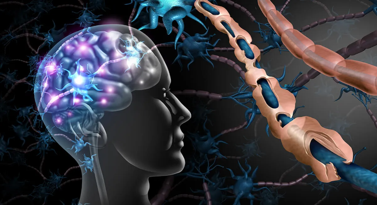 stwardnienie rozsiane diagnostyka PMR