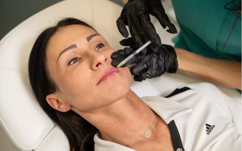 hialuronidaza zabieg medycyna estetyczna