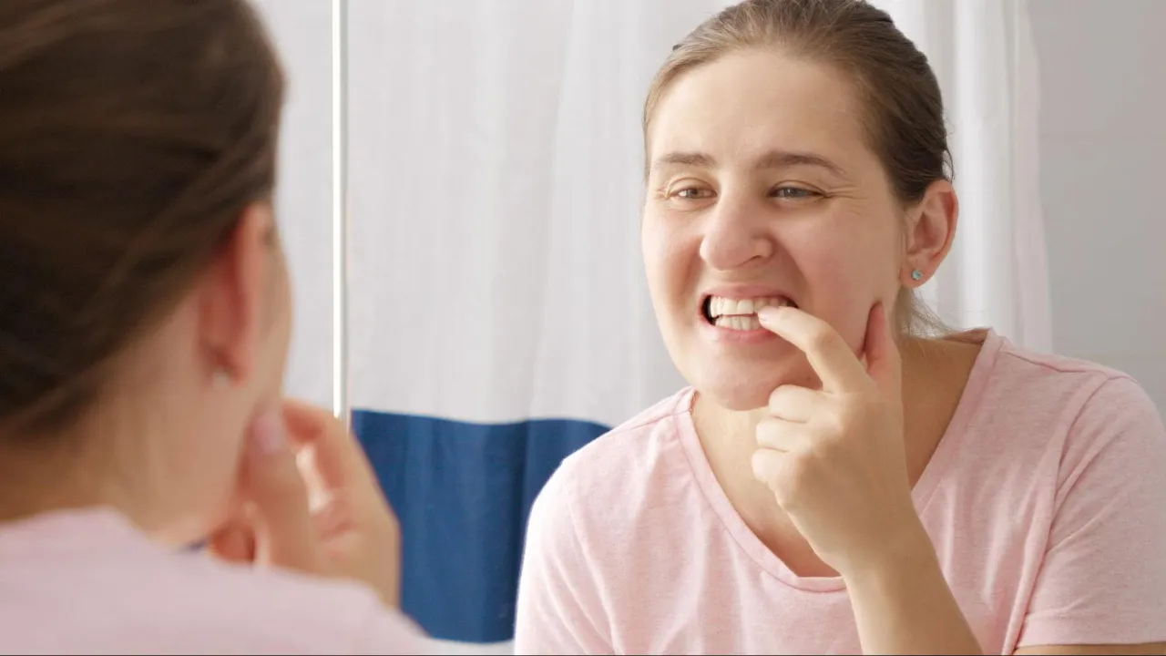 Przyczyny ruszania się zęb&oacute;w stałych grafika