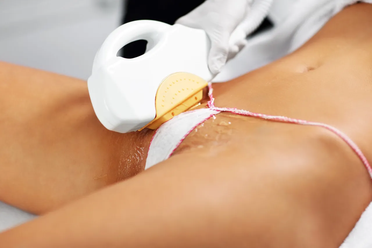 Zabieg depilacji laserowej okolic bikini. Co to jest bikini głębokie? To usuwanie owłosienia z całej linii bielizny, pachwin i wzgórka łonowego.